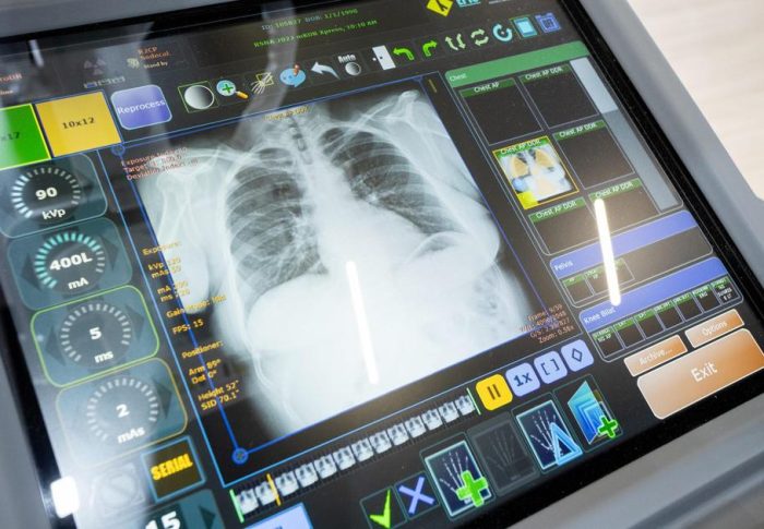 Conheça a tecnologia que está por detrás da máquina de raio x